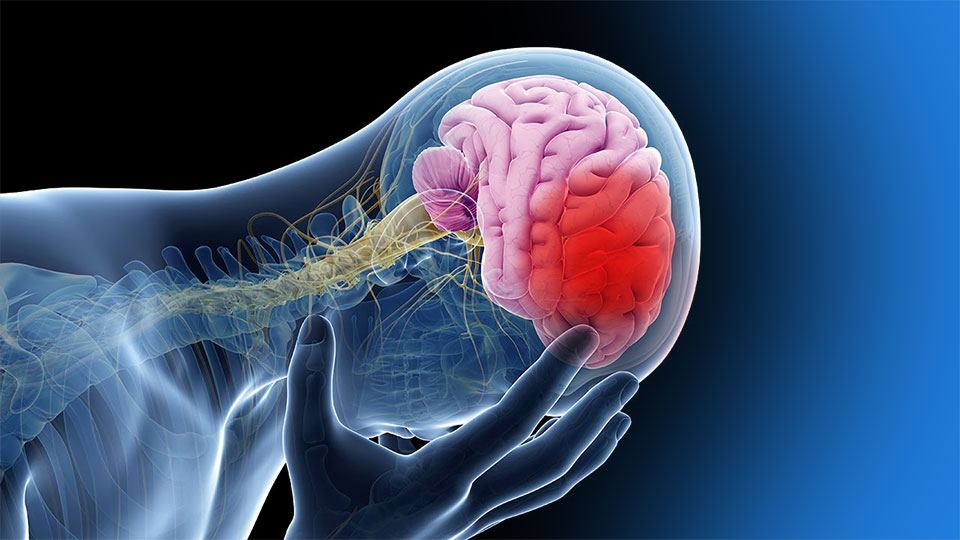Accidente Cerebro Vascular: 29 de Octubre, Día Mundial